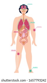 Man full-length with designation of pain points in joints and internal organs. Vector illustration of human anatomy, zone of injury in flat style. Medical laboratory research, pain in arm and leg