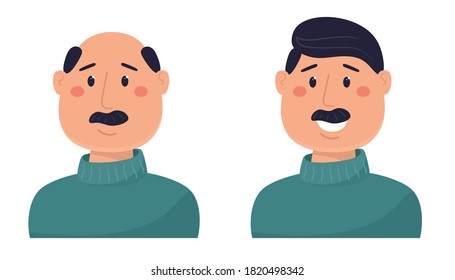 A man with hair and balding. Vector illustration in flat style.