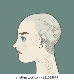 a man hair loss from cancer background