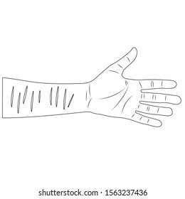 man hand with scars on wrist after suicide attempt. isolated outline stock vector illustration