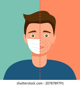 Man having acne problem caused by face mask in flat design. Maskne (mask and acne) skin problem concept vector illustration.