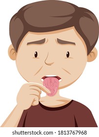 A Man Having Dry Mouth Illustration