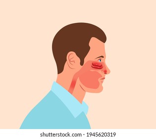 Man having rhinitis, allergy or nasal infection. Human head vector  illustration