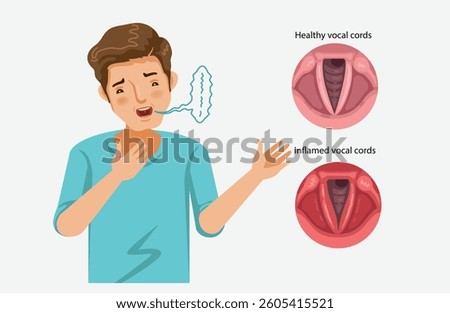 Man With Hoarse Voice Due to Bronchitis Illustration
