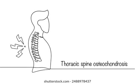 A man with pain in the thoracic spine. Thoracic spine osteochondrosis. Pathological condition of the osteochondral tissue of the thoracic region. 