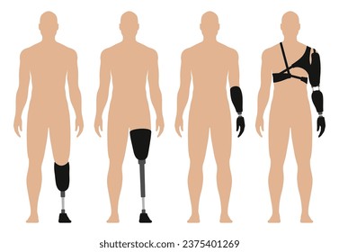 Man with prosthetic arm and leg, medical vector illustration set, isolated on white background.