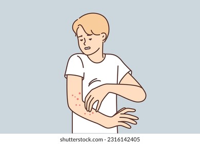 Man with rash on arm suffers from itching and eczema caused by infection that affects skin. Guy needs medicated ointment or dermatologist help to get rid of eczema spreading all over body