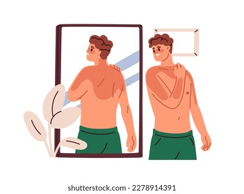 Man with reddish body after sun UV, looking at skin sunburns in mirror. Suntan burns problem on body. Sad person with burnt spots. Flat graphic vector illustration isolated on white background