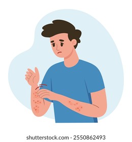 Hombre rascándose la mano. Picazón alérgica, inflamación de la piel, enrojecimiento e irritación. Dermatitis atópica, eccema, psoriasis. Salud y medicina.