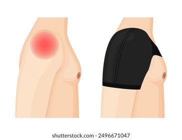 Man with Shoulder Pain Before and After Wearing Medical Brace