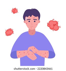 Man sick with monkeypox virus in flat style