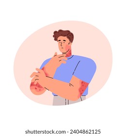 Hombre con problemas de piel y enfermedades en las manos. Ilustración vectorial en estilo plano de caricatura, aislada en fondo blanco. Paciente masculino con psoriasis. Triste enfermo con reacción alérgica en su cuerpo.