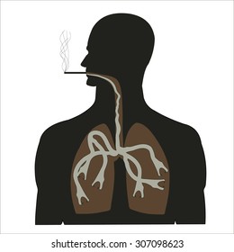 man smokes with diseased lungs silhouetted on a white background 
