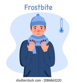 Man suffering from frostbite. Guy with frozen hands in winter season in flat design. Skin burn symptom.