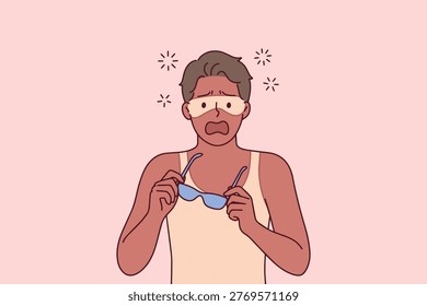 Man suffering from severe sunburn with visible tan lines from sunglasses and clothes. Concept of skin damage, UV protection failure, and beach safety.
