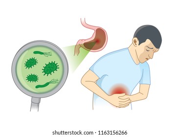 Man Suffering from stomach ache symptom because bacterial. Concept Illustration about hygiene and health.