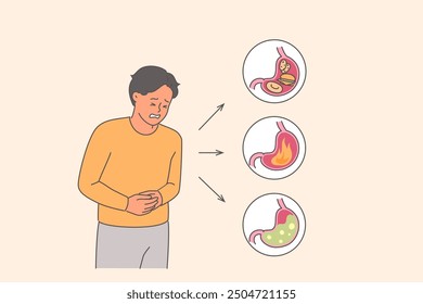 El hombre sufre de dolor abdominal debido a problemas estomacales y necesita la ayuda de un gastroenterólogo. Acidez gástrica y gastritis en un hombre joven que lleva un estilo de vida poco saludable que causa sobrecarga estomacal