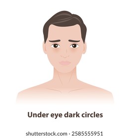 The man with under eye dark circles on face vector illustration on white background. Skin problems in men include dark circles, eye bags, puffiness, dryness, crow feet lines. Men skin care concept.