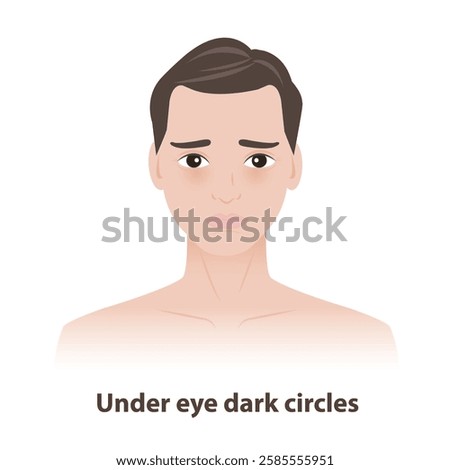 The man with under eye dark circles on face vector illustration on white background. Skin problems in men include dark circles, eye bags, puffiness, dryness, crow feet lines. Men skin care concept.
