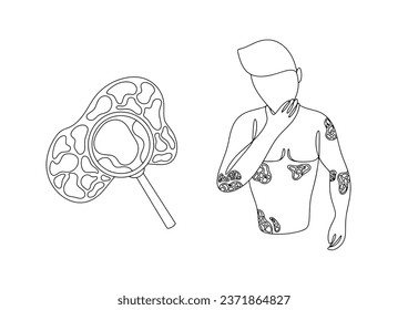 Ein Mann ist verärgert über das Vorhandensein von Psoriasis auf seinem Körper. Internationaler Tag der Psoriasis. Eine Zeilenzeichnung für verschiedene Verwendungszwecke. Vektorgrafik.