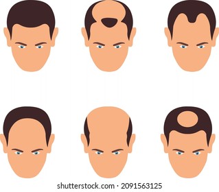 man with various receding hairs