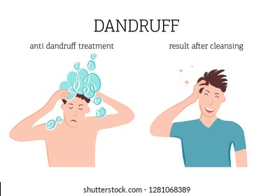 A man washes his head with therapeutic dandruff shampoo. The man is glad that the dandruff has disappeared after shampooing. Vector illustration of skin disease problem