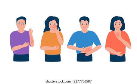 Man and woman scratching body, rash, allergy, acne on skin. People suffering from itchy skin, symptom disease. Vector illustration