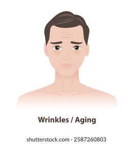 The man with wrinkles and fine lines on face vector illustration isolated on white background. Skin problems in men include aging, particularly around the eyes and forehead. Men skin care concept.