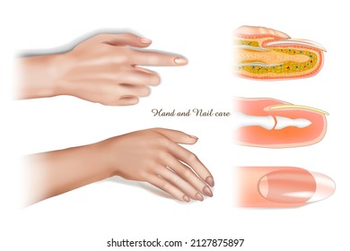 Manicure for the care of hands and nails. Realistic vector illustration of female hands and nails. Structure of the nail. Anatomy of a finger and nail in section