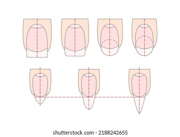 Manicure instruction. Nails vector illustrations. Lady fingers.