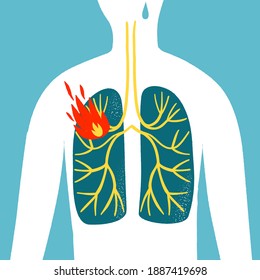 Man's Body Silhouette With Lungs And Fire Inside. Pneumonia And Lungs Diseases. Medical Illustration For Your Design.