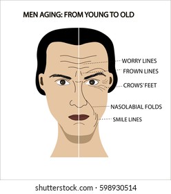 Man's face demonstrating aging with wrinkles and folds