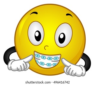 Mascot Illustration of a Happy Smiley in Colorful Braces Showing the Dental Work Done on Him