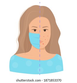 Maskne Concept. Acne Caused Wearing Face Mask Due To Coronavirus Pandemic. Flat Female Character Portrait Struggling With Pimples, Face Skin Problems. Cosmetology, Treatment, Covid-19. Vector Isolated