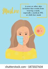 Maskne concept. Infographic vector illustration with defenition of maskne - acne or irritation caused by wearing protective face mask. Female portrait, woman character with maskne closeup.