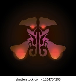 maxillary sinuses with a point of pain and inflammation.. Sinusitis. Sinus infection is inflammation of the sinuses. rhinosinusitis