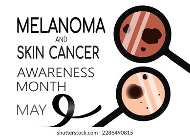 May is melanoma and skin cancer awareness month background template with moles, birthmarks checked under magnifier. Black ribbon sign. Vector illustration