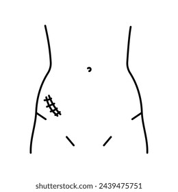 Mcburney incision line icon. Abdominal incisions. Vector isolated element. Editable stroke.