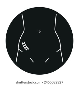 Mcburney incision line icon. Abdominal incisions. Vector isolated element. Editable stroke.
