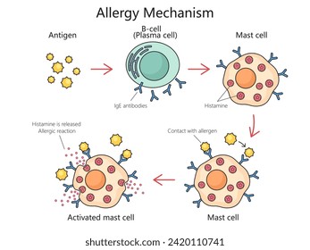 Mechanism of allergy action diagram hand drawn schematic vector illustration. Medical science educational illustration