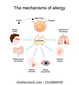 Mechanism of allergy. Mast cells and allergic reaction. Histamine. local immune responses. vector illustration