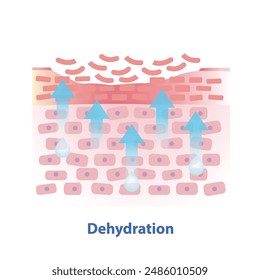 The mechanism of dehydration skin vector illustration. Cross section of dry skin barrier layer lead to more water leaving skin and lacks water in the uppermost layer. Skin care and beauty concept.