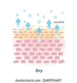 The mechanism of dry skin vector illustration isolated on white background. Cross section of lack of natural oil on skin layer causes more transepidermal water loss. Skin care and beauty concept.