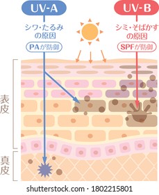 Ilustración de una quemadura solar
Incluye la siguiente transcripción japonesa. "Epidermis" "corium" "la causa de las arrugas y la holgura" "la causa de la mancha y la peca"