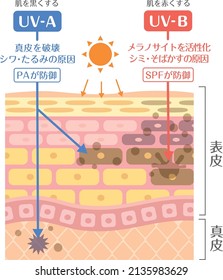 Mechanism explanation illustration of a sunburn
It includes the following Japanese transcription."Epidermis" "corium" "the cause of the wrinkles and the slack" "the cause of the stain and the freckle"