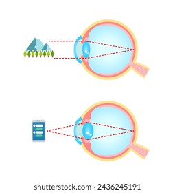 Mechanism of eyeball for looking far and near. Vector illustration.