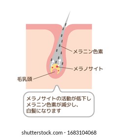 Mechanism of gray hair vector illustration / Japanese. translation: Melanin pigment, Melanocyte, papilla, Reduces melanocyte activity 
and decreases melanin 
pigmentation. It causes gray hair.