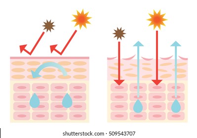 Mechanism Of Healthy Skin And Dry Skin 