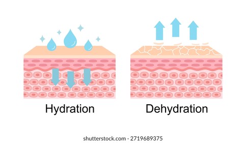 El mecanismo de hidratación y deshidratación de la Ilustración vectorial de la capa de la piel sobre fondo blanco. La comparación de la piel absorbe el agua, la humedad y la piel seca carece de agua en la capa superior.
