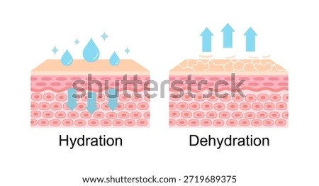 The mechanism of hydration and dehydration skin layer vector illustration on white background. Comparison of skin absorb water, moisture and dry skin lacks water in the uppermost layer.